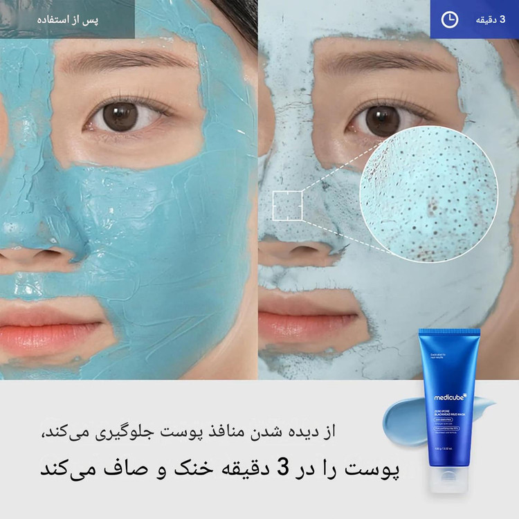 ماسک کنترل منافذ و ضد جوش سرسیاه مدی کیوب